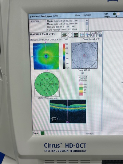High-demended OCT&nbsp;|&nbsp;Carl Zeiss&nbsp;|&nbsp;Cirrus 4000 HD OCT