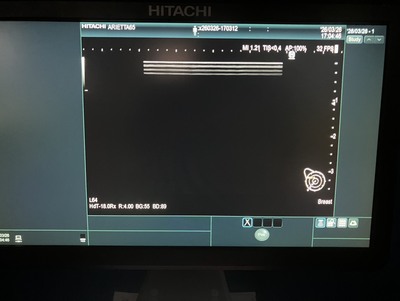 Ultrasound&nbsp;|&nbsp;HITACHI&nbsp;|&nbsp;Arietta 65