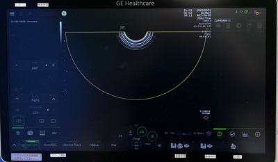 4D Ultrasound&nbsp;|&nbsp;GE&nbsp;|&nbsp;Voluson Swift BT23