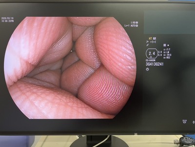 上部消化管経鼻用ビデオスコープ&nbsp;|&nbsp;富士フイルムメディカル株式会社&nbsp;|&nbsp;EG-6400Nの写真