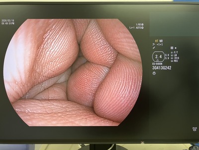 上部消化管経鼻用ビデオスコープ&nbsp;|&nbsp;富士フイルムメディカル株式会社&nbsp;|&nbsp;EG-6400Nの写真