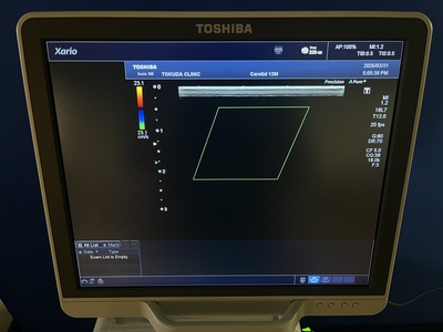 Color Doppler&nbsp;|&nbsp;CANON&nbsp;|&nbsp;TUS-X100 Xario 100