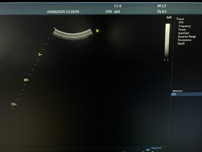 Ultrasound System&nbsp;|&nbsp;GE&nbsp;|&nbsp;Vivid S60N