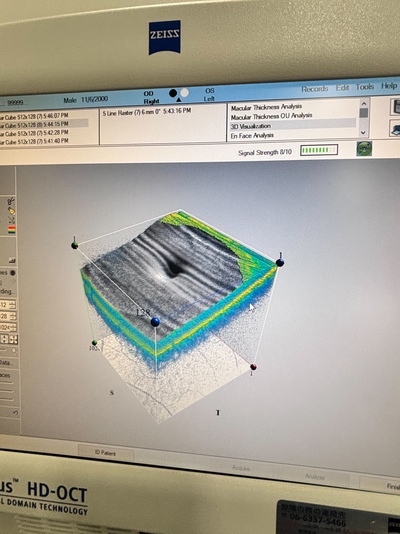 Windows 10 PRO Zeiss OCT&nbsp;|&nbsp;Carl Zeiss&nbsp;|&nbsp;Cirrus 4000 HD OCT