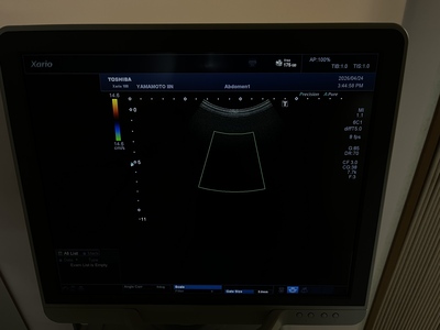 Color Doppler&nbsp;|&nbsp;CANON&nbsp;|&nbsp;TUS-X100 Xario 100