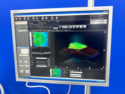 Advanced OCT&nbsp;|&nbsp;NIDEK&nbsp;|&nbsp;RS-3000 Advance