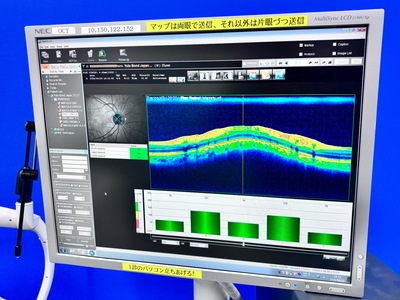 ANGIOGRAPHY installed OCT&nbsp;|&nbsp;NIDEK&nbsp;|&nbsp;RS-3000 Advance