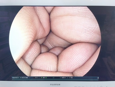 Endoscopy Sytem&nbsp;|&nbsp;FUJIFILM&nbsp;|&nbsp;EPX-4450