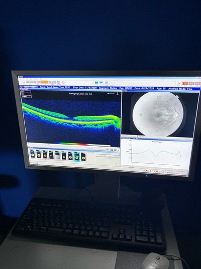 Windows 7 Pro OCT&nbsp;|&nbsp;TOPCON&nbsp;|&nbsp;3D OCT 2000 FA