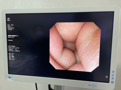 Endoscopy System&nbsp;|&nbsp;OLYMPUS&nbsp;|&nbsp;LUCERA ELITE CV-290