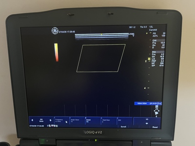 Color Doppler&nbsp;|&nbsp;GE&nbsp;|&nbsp;LOGIQ e V2