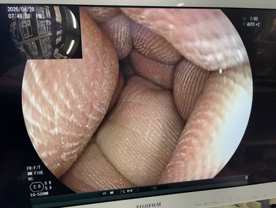 Endoscopy System&nbsp;|&nbsp;FUJIFILM&nbsp;|&nbsp;EPX-4450HD