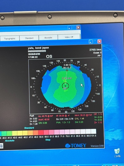 Corneal Topographer System&nbsp;|&nbsp;TOMEY&nbsp;|&nbsp;TMS-4