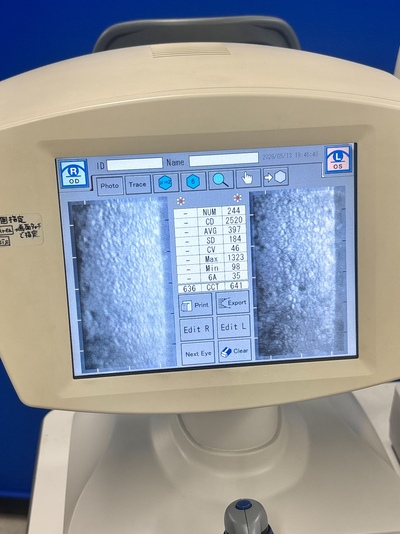 Specular Microscope&nbsp;|&nbsp;TOMEY&nbsp;|&nbsp;EM-3000
