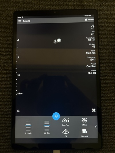 Mobile Ultrasound&nbsp;|&nbsp;PHILIPS&nbsp;|&nbsp;795005/Lumify System