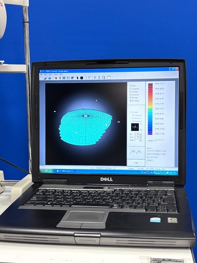 Corneal Topographer System&nbsp;|&nbsp;SHIN-NIPPON&nbsp;|&nbsp;CT-1000