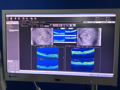 Advanced OCT + Fundus camera&nbsp;|&nbsp;NIDEK&nbsp;|&nbsp;RS-330 Retina Scan Duo
