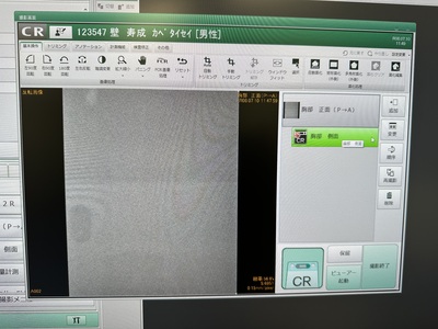 &nbsp;|&nbsp;FUJIFILM&nbsp;|&nbsp;FCR PRIMA（CR-IR 391RU）