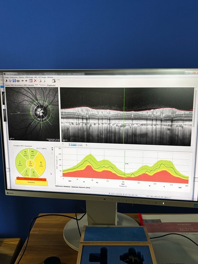 HRA2+ OCT+ WWE(55°), Retina and Glaucoma Module&nbsp;|&nbsp;Heidelberg Engineering GmbH&nbsp;|&nbsp;SPECTRALIS OCT2