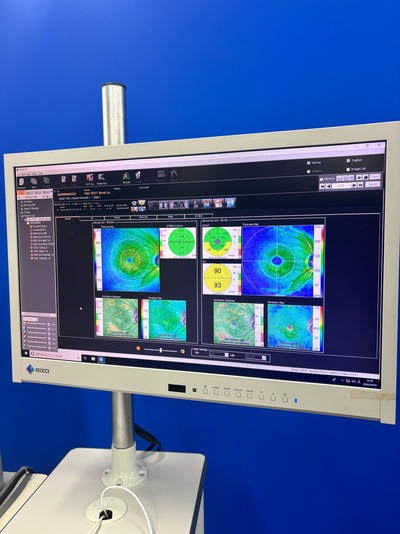 12-megapixel fundus photography × ultra-high-definition OCT&nbsp;|&nbsp;NIDEK&nbsp;|&nbsp;RS-330 Retina Scan Duo
