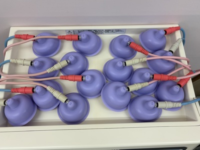 干渉波治療器&nbsp;|&nbsp;株式会社日本メディックス&nbsp;|&nbsp;SD-5402の写真