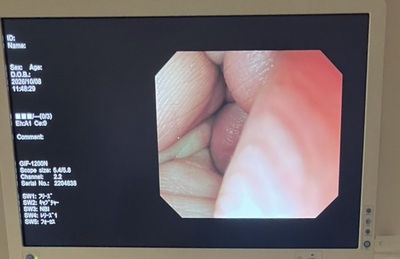 Endoscopy System&nbsp;|&nbsp;OLYMPUS&nbsp;|&nbsp;LUCERA ELITE CV-290