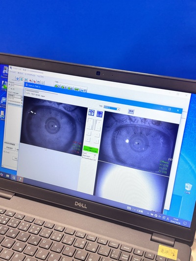 Placido Topography Meets 3-D Scheimpflug Imaging—A Hybrid Anterior Segment Analyzer Capturing the Full Corneal Profile in 0.5 Seconds.&nbsp;|&nbsp;TOMEY&nbsp;|&nbsp;TMS-5
