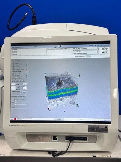 国内再販不可）高機能OCTの決定版&nbsp;|&nbsp;カールツァイスメディテック株式会社&nbsp;|&nbsp;Cirrus 5000 HD-OCTの写真