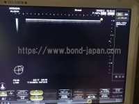 超音波診断装置&nbsp;|&nbsp;日立製作所&nbsp;|&nbsp;Noblusの写真