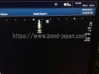 超音波診断装置/カラードプラ&nbsp;|&nbsp;キャノンメディカル株式会社&nbsp;|&nbsp;Aplio 400の写真