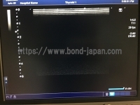 超音波診断装置/カラードプラ&nbsp;|&nbsp;キャノンメディカル株式会社&nbsp;|&nbsp;Aplio 400の写真