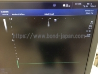 超音波診断装置/カラードプラ&nbsp;|&nbsp;キャノンメディカル株式会社&nbsp;|&nbsp;TUS-X100 Xario 100の写真
