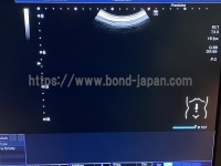 Color Doppler&nbsp;|&nbsp;CANON&nbsp;|&nbsp;TUS-X100 Xario 100