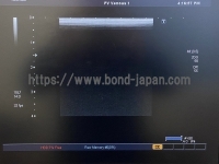 Color Doppler&nbsp;|&nbsp;CANON&nbsp;|&nbsp;SSA-790A Aplio XG