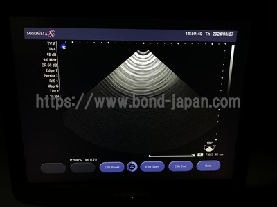 &nbsp;|&nbsp;SIEMENS&nbsp;|&nbsp;Sonovista FX PE