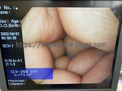 Video Gastroscope&nbsp;|&nbsp;OLYMPUS&nbsp;|&nbsp;GIF-Q260