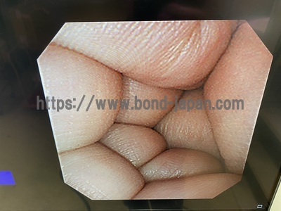 上部消化管ビデオスコープ&nbsp;|&nbsp;オリンパス&nbsp;|&nbsp;GIF-XP260NSの写真