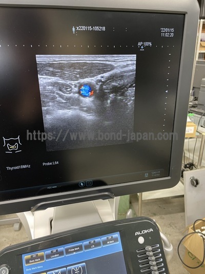 超音波診断装置&nbsp;|&nbsp;富士フイルムメディカル株式会社&nbsp;|&nbsp;ARIETTA S70の写真