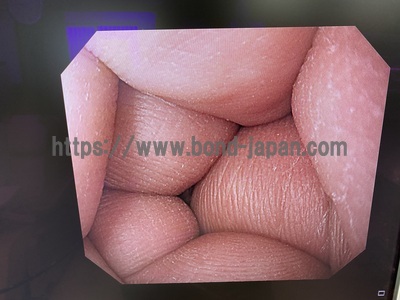 上部消化管汎用ビデオスコープ&nbsp;|&nbsp;オリンパス&nbsp;|&nbsp;GIF-H290の写真