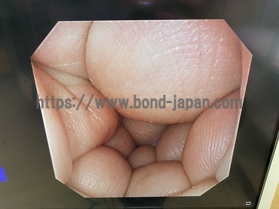 Video Gastroscope&nbsp;|&nbsp;OLYMPUS&nbsp;|&nbsp;GIF-XP290N