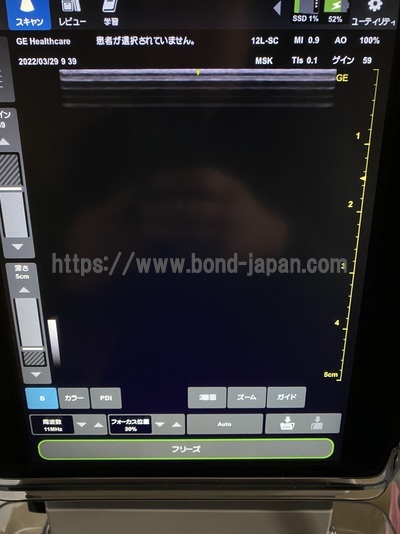 Color Doppler&nbsp;|&nbsp;GE&nbsp;|&nbsp;Venue 50