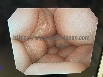 Video Gastroscope&nbsp;|&nbsp;OLYMPUS&nbsp;|&nbsp;GIF-H290Z