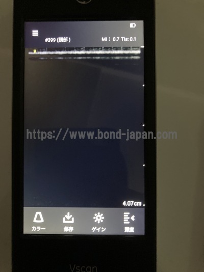 汎用超音波画像診断装置&nbsp;|&nbsp;GEヘルスケア・ジャパン株式会社&nbsp;|&nbsp;Vscan Extend R2の写真
