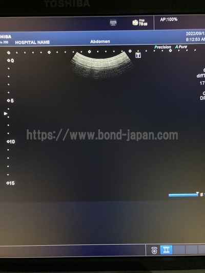 超音波診断装置/カラードプラ&nbsp;|&nbsp;キャノンメディカル株式会社&nbsp;|&nbsp;Xario 200の写真