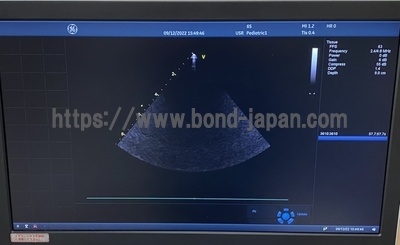 超音波診断装置（循環器向け）&nbsp;|&nbsp;GEヘルスケア・ジャパン株式会社&nbsp;|&nbsp;Vivid S70N Urtla Editionの写真
