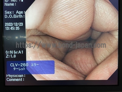 Video Colonoscope&nbsp;|&nbsp;OLYMPUS&nbsp;|&nbsp;PCF-Q260AZI