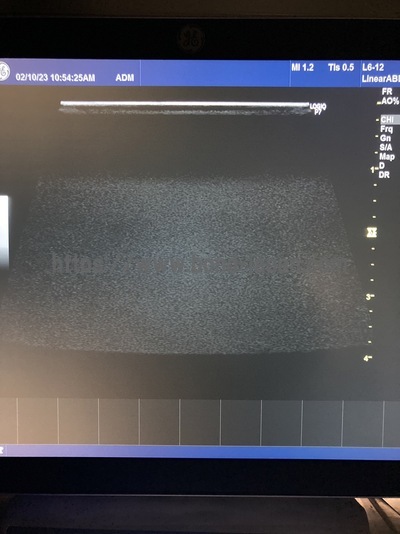 超音波診断装置&nbsp;|&nbsp;GEヘルスケア・ジャパン株式会社&nbsp;|&nbsp;LOGIQ P7 Vetの写真