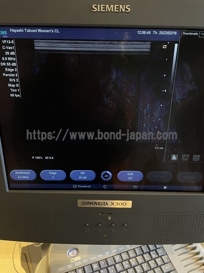 Color Doppler&nbsp;|&nbsp;SIEMENS&nbsp;|&nbsp;X300
