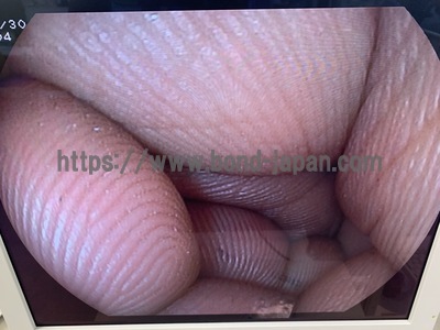 Video Gastroscope&nbsp;|&nbsp;FUJIFILM&nbsp;|&nbsp;EG-3000FP