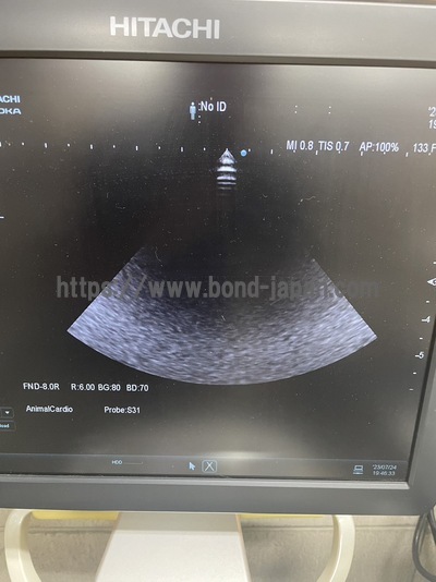 超音波診断装置&nbsp;|&nbsp;日立製作所&nbsp;|&nbsp;ARIETTA 60の写真